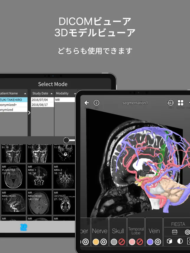 Screenshot 1 palm : DICOM & 3DModel Viewer iphone