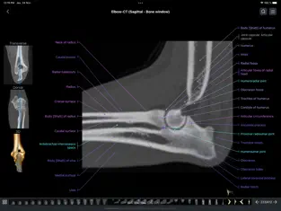 Imágen 3 vet-Anatomy iphone