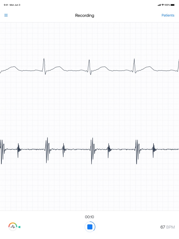 Eko Digital Stethoscope,ECG