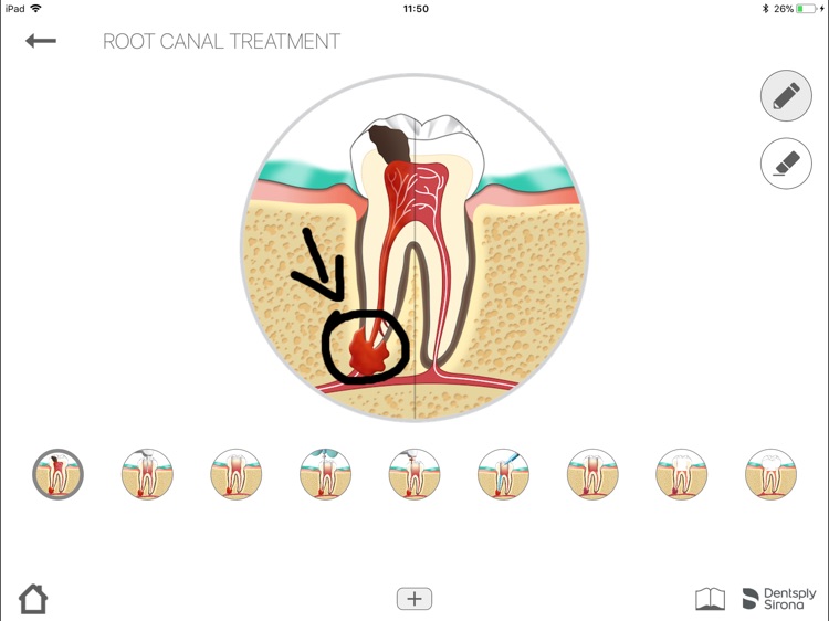 Endo IQ® App screenshot-6