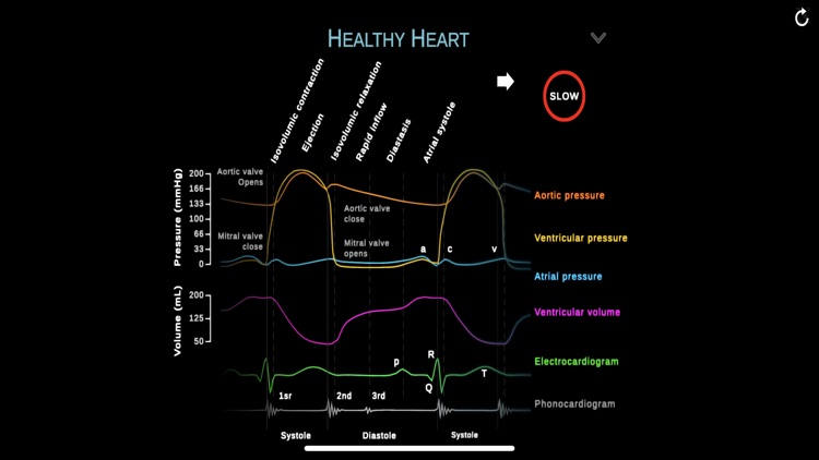 TheHeartPhysiologyApp screenshot-4